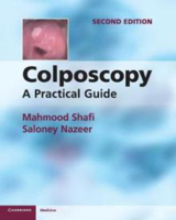 Picture of Colposcopy