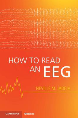 Picture of How to Read an EEG