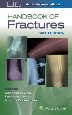 Picture of Handbook of Fractures