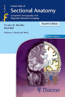 Picture of Pocket Atlas of Sectional Anatomy, Volume I: Head and Neck: Computed Tomography and Magnetic Resonance Imaging