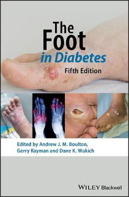 Picture of The Foot in Diabetes