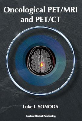 Picture of Oncological PET/MRI and PET/CT