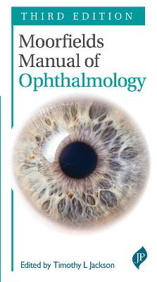 Picture of Moorfields Manual of Ophthalmology