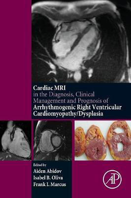 Picture of Cardiac MRI in Diagnosis, Clinical Management, and Prognosis of Arrhythmogenic Right Ventricular Cardiomyopathy/Dysplasia