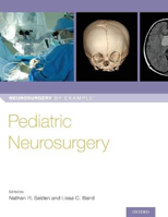 Picture of Pediatric Neurosurgery