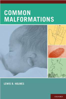 Picture of Common Malformations