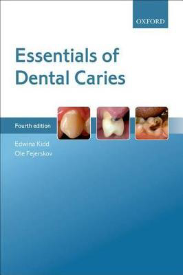 Picture of Essentials of Dental Caries