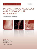Picture of Challenging Concepts in Interventional Radiology