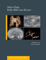 Picture of Mayo Clinic Body MRI Case Review