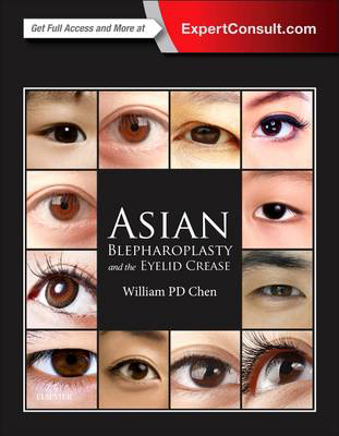 Picture of Asian Blepharoplasty and the Eyelid Crease