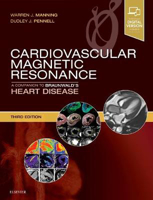 Picture of Cardiovascular Magnetic Resonance: A Companion to Braunwald's Heart Disease