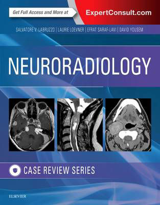 Picture of Neuroradiology Imaging Case Review