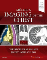 Picture of Muller's Imaging of the Chest: Expert Radiology Series