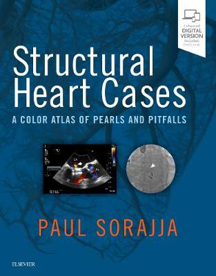 Picture of Structural Heart Cases: A Color Atlas of Pearls and Pitfalls