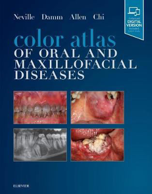 Picture of Color Atlas of Oral and Maxillofacial Diseases