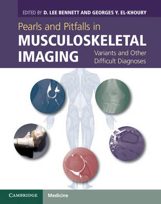 Picture of Pearls and Pitfalls in Musculoskeletal Imaging: Variants and Other Difficult Diagnoses