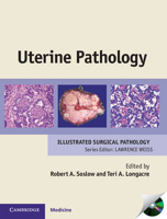 Picture of Uterine Pathology