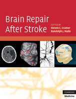 Picture of Brain Repair After Stroke