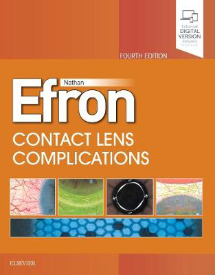 Picture of Contact Lens Complications
