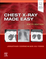 Picture of Chest X-Ray Made Easy