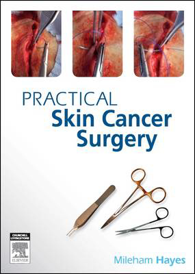 Picture of Practical Skin Cancer Surgery