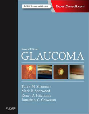 Picture of Glaucoma: 2-Volume Set