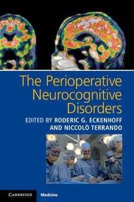 Picture of The Perioperative Neurocognitive Disorders