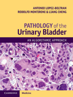 Picture of Pathology of the Urinary Bladder: An Algorithmic Approach