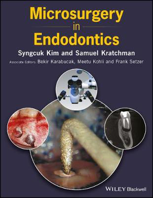 Picture of Microsurgery in Endodontics