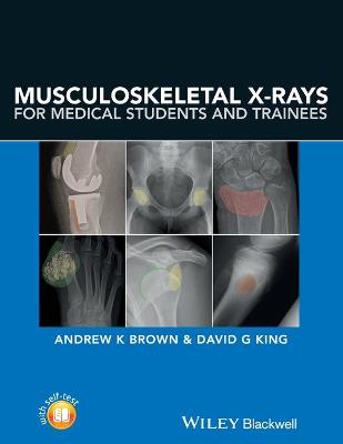 Picture of Musculoskeletal X-Rays for Medical Students and Trainees