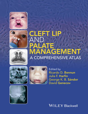 Picture of Cleft Lip and Palate Management: A Comprehensive Atlas