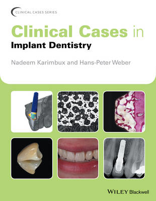 Picture of Clinical Cases in Implant Dentistry