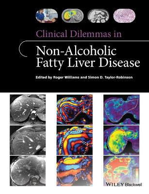 Picture of Clinical Dilemmas in Non-Alcoholic Fatty Liver Disease