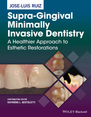 Picture of Supra-Gingival Minimally Invasive Dentistry: A Healthier Approach to Esthetic Restorations
