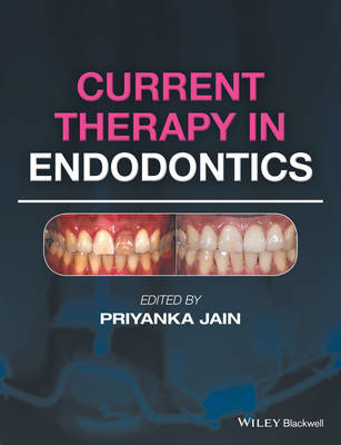 Picture of Current Therapy in Endodontics