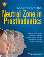 Picture of Application of the Neutral Zone in Prosthodontics