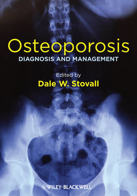 Picture of Osteoporosis: Diagnosis and Management