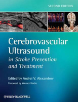 Picture of Cerebrovascular Ultrasound in Stroke Prevention and Treatment