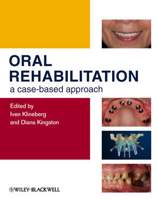 Picture of Oral Rehabilitation: A Case-Based Approach
