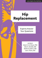 Picture of Hip Replacement: Experts Answer Your Questions