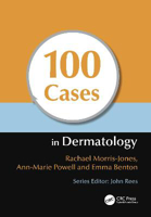 Picture of 100 Cases in Dermatology
