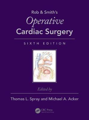 Picture of Operative Cardiac Surgery