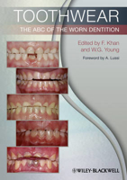 Picture of Toothwear: The ABC of the Worn Dentition