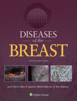 Picture of Diseases of the Breast