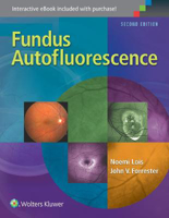 Picture of Fundus Autofluorescence