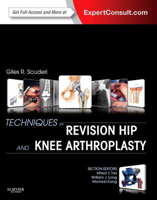 Picture of Techniques in Revision Hip and Knee Arthroplasty