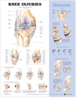 Picture of Knee Injuries Anatomical Chart