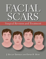 Picture of Facial Scars: Surgical Revision and Treatment