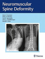 Picture of Neuromuscular Spine Deformity