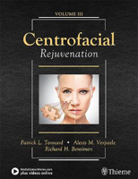 Picture of Centrofacial Rejuvenation